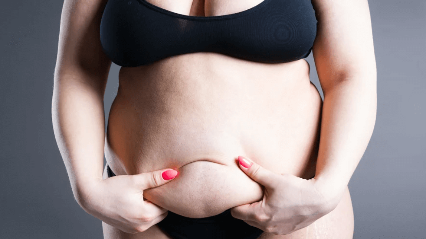 woman excess belly skin